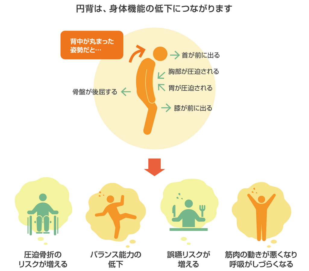 骨の変形による円背は改善できますか? _ 円背 治し方 高齢者 – NIQYS