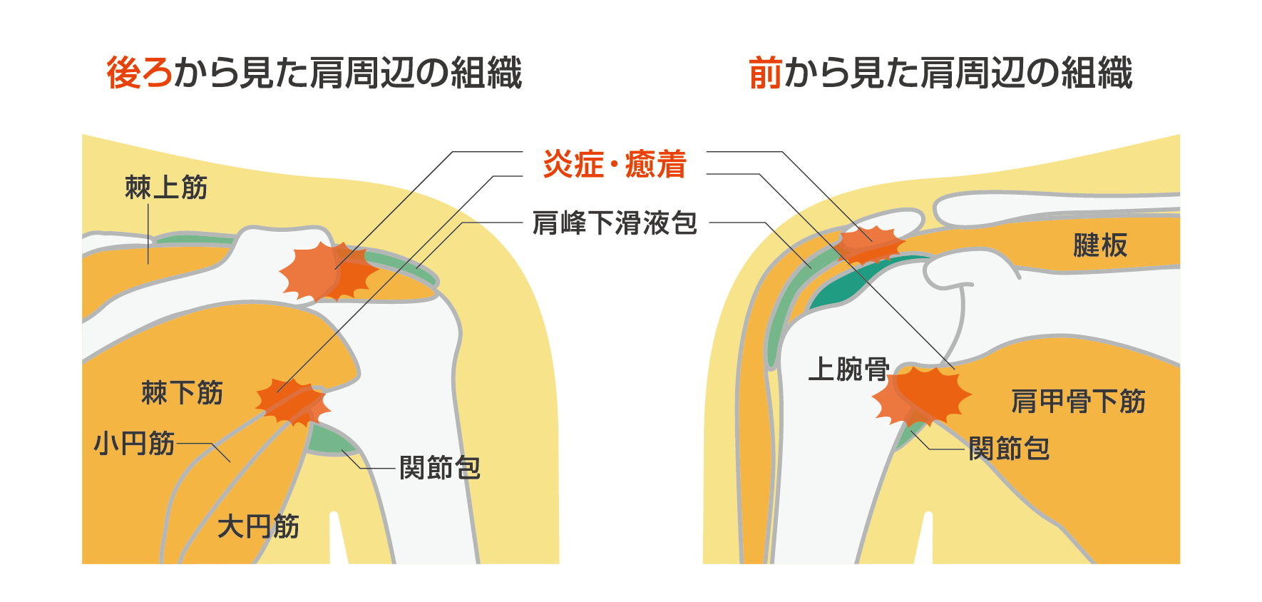 介護予防コラム Br 理学療法士が教える 四十肩 五十肩 肩関節周囲炎 運動 お知らせ 桜十字の新感覚リハビリジム Let Sリハ