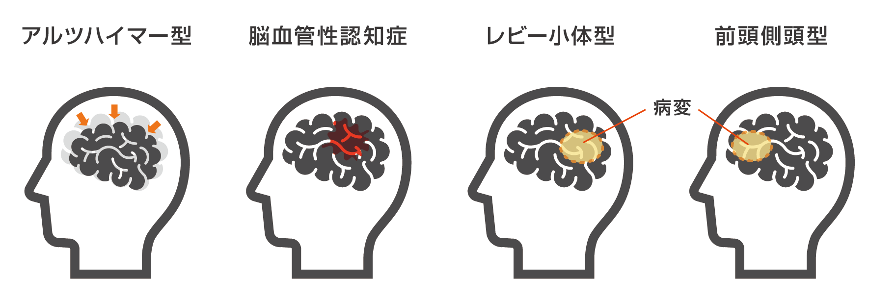 介護予防コラム Br 認知症予防には運動も効果的 お知らせ 桜十字の新感覚リハビリジム Let Sリハ