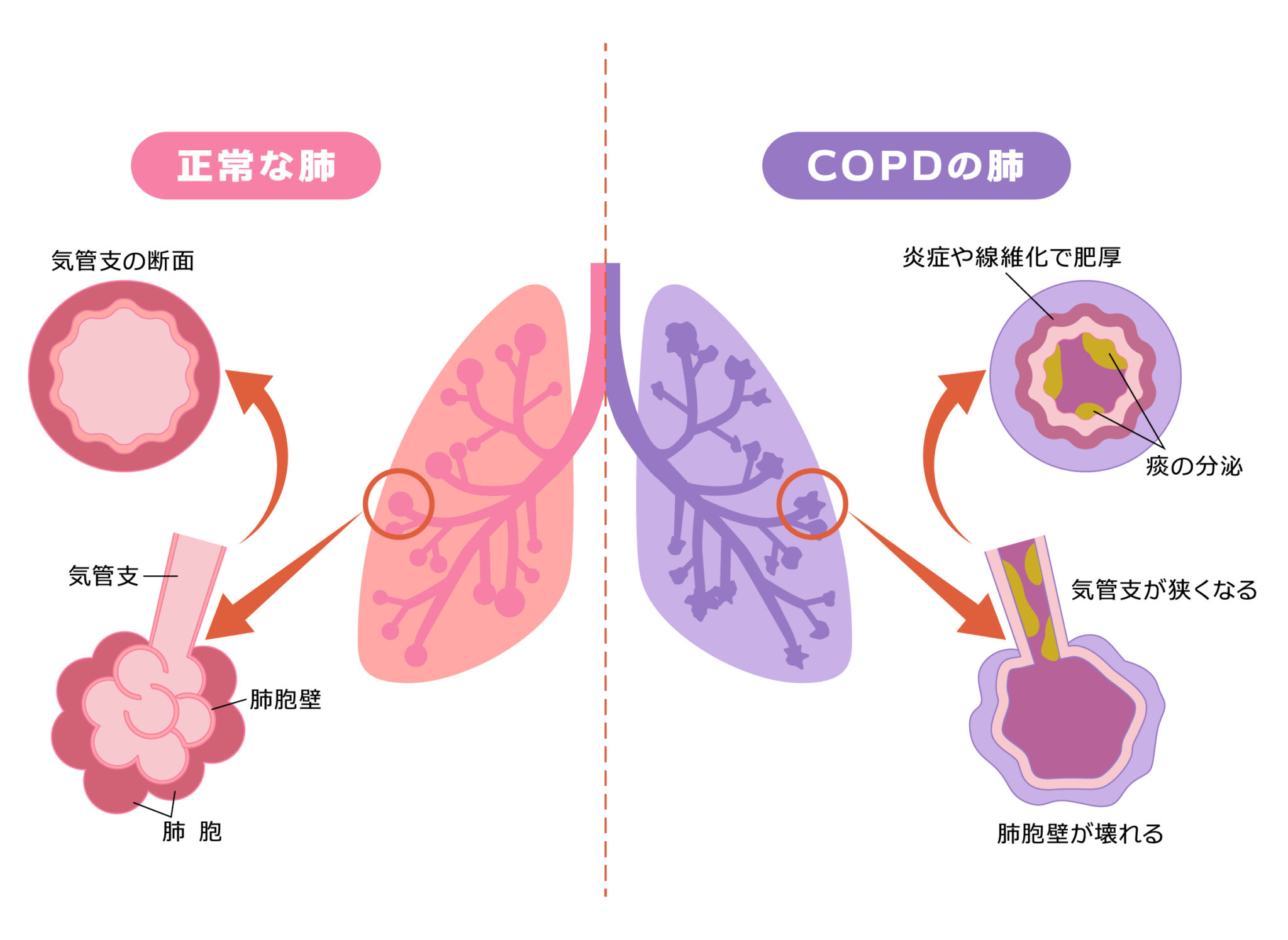 どのくらい一般的ですか?